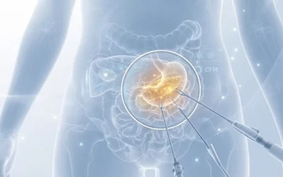 Cirurgia bariátrica: novos critérios do CFM