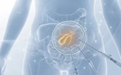 Cirurgia da vesícula: como é a recuperação
